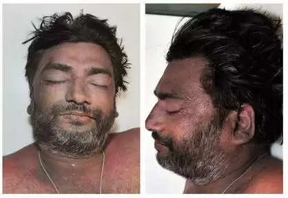 മരിച്ചയാളെ തിരിച്ചറിയുമോ?