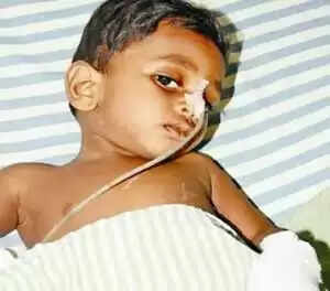 ഒരു വയസുകാരന്റെ വയറ്റില് നിന്നും ശസ്ത്രക്രിയയിലൂടെ പുറത്തെടുത്തത് 22 സൂചികള്
