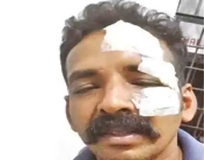 വളര്ത്തുനായയെ ഉലക്കകൊണ്ടടിച്ചുകൊന്നശേഷം ബന്ധുവീട്ടില് കയറി ഹൃദ്രോഗിയായ ഗൃഹനാഥനെയും ഭാര്യയെയും മകനെയും അടിച്ചു പരിക്കേല്പിച്ചു; യുവാവ് അറസ്റ്റില്