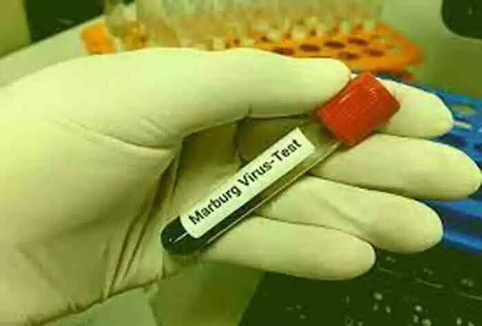Marburg virus | കോവിഡിനും വാനരവസൂരിയുടെ ഭീഷണിക്കുമിടയിൽ ആശങ്ക പടർത്തി മാർബർഗ് വൈറസ്; 2 രോഗികൾ മരിച്ചു; മുന്നറിയിപ്പ് നൽകി ലോകാരോഗ്യ സംഘടനയും; മരണനിരക്ക് 88 ശതമാനം വരെ! ലക്ഷണങ്ങൾ, പടരുന്നതെങ്ങനെ, കൂടുതൽ അറിയാം