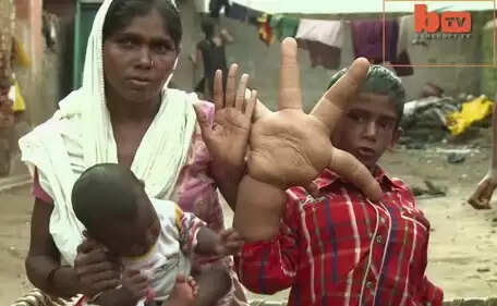 13 കിലോ ഭാരമുള്ള കൈകള്