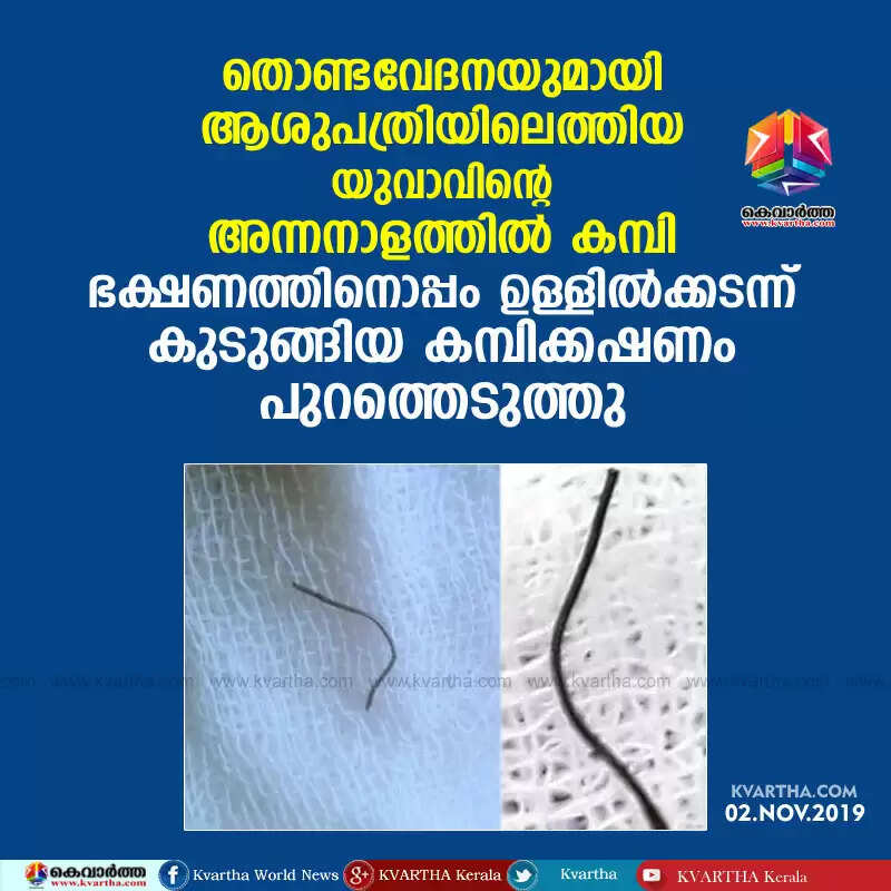 തൊണ്ടവേദനയുമായി ആശുപത്രിയിലെത്തിയ യുവാവിന്റെ അന്നനാളത്തില് കമ്പി; ഭക്ഷണത്തിനൊപ്പം ഉള്ളില്ക്കടന്ന് കുടുങ്ങിയ കമ്പിക്കഷണം പുറത്തെടുത്തു