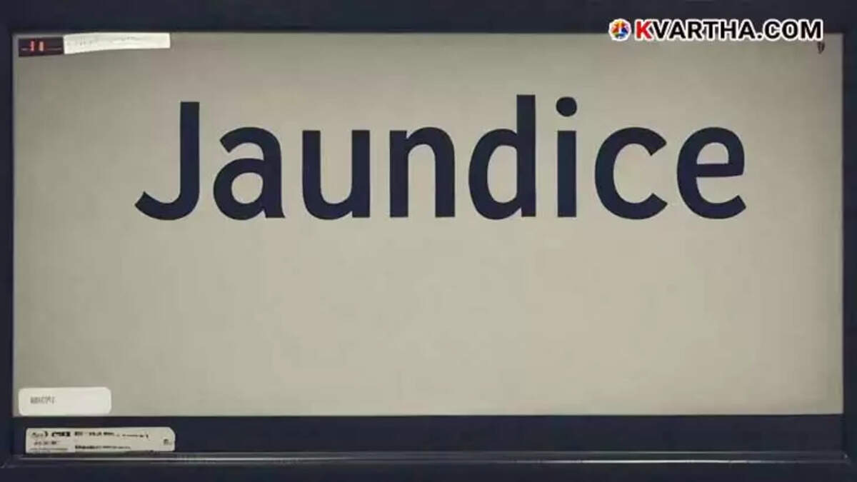 Thaliparamba Jaundice Spread Measures