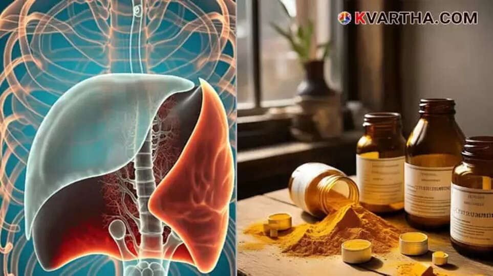 Image Representing Turmeric Supplements Require Caution