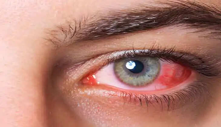 eye