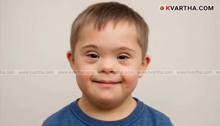A boy displaying characteristic facial features of Down syndrome