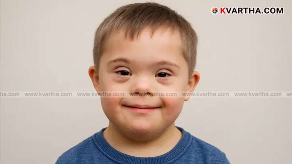 A boy displaying characteristic facial features of Down syndrome