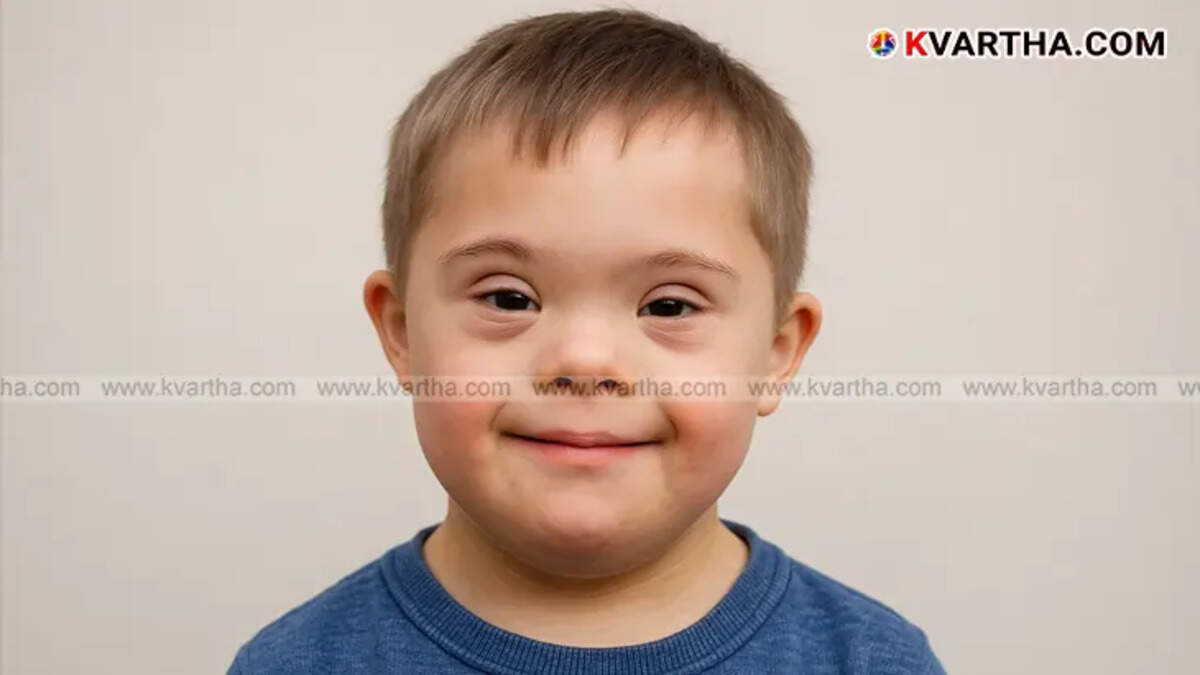 A boy displaying characteristic facial features of Down syndrome