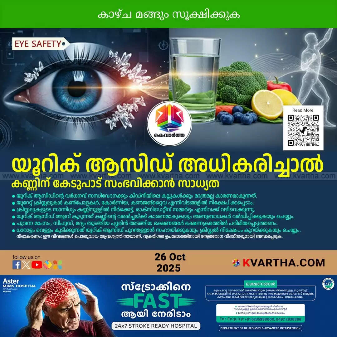high uric acid dangers eye vision loss