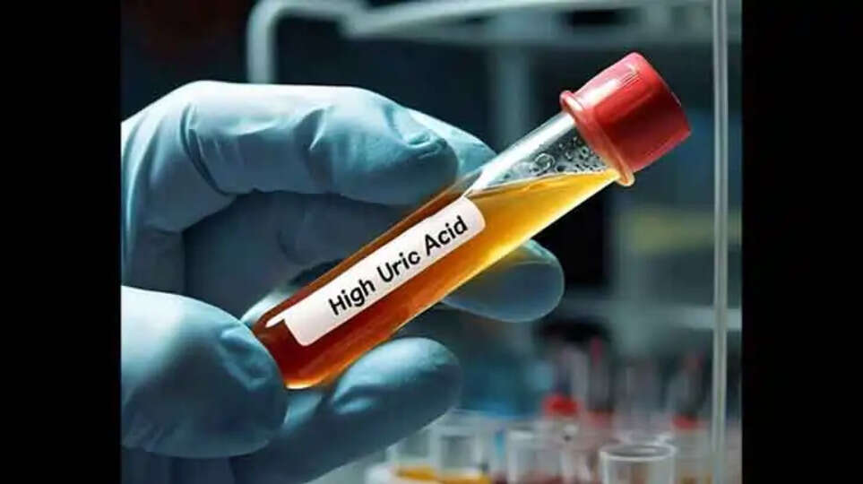 Uric Acid