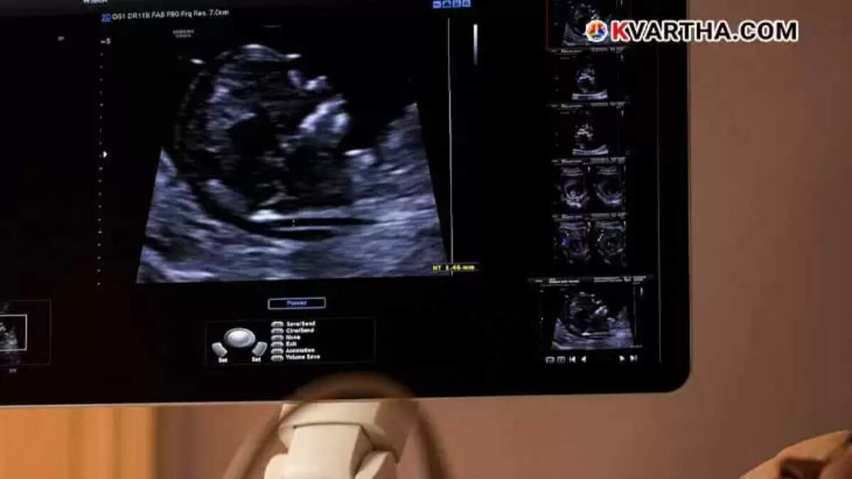  Anomaly Scanning Fetal Health