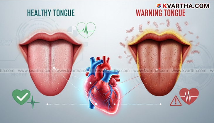 Image of a healthy light-pink tongue.