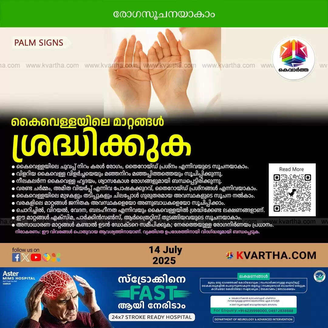 diseases in palm color lines dont ignore signs