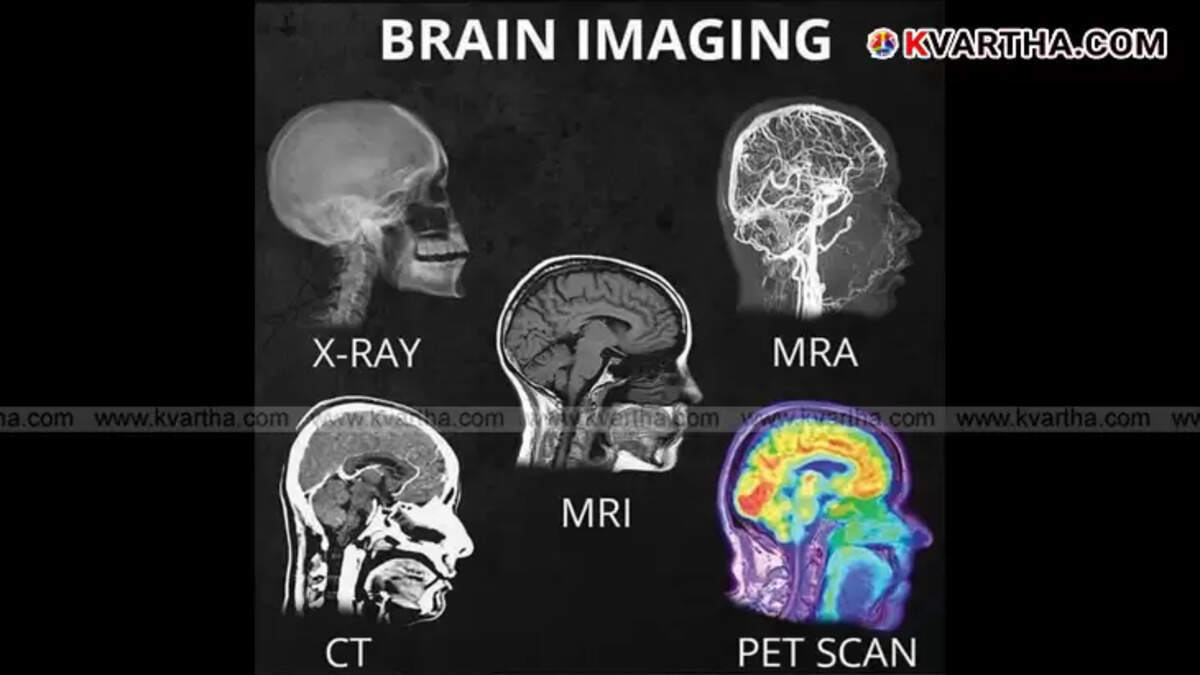 Different types of brain scans - X-ray, CT scan, MRI, MRA, and PET scan.