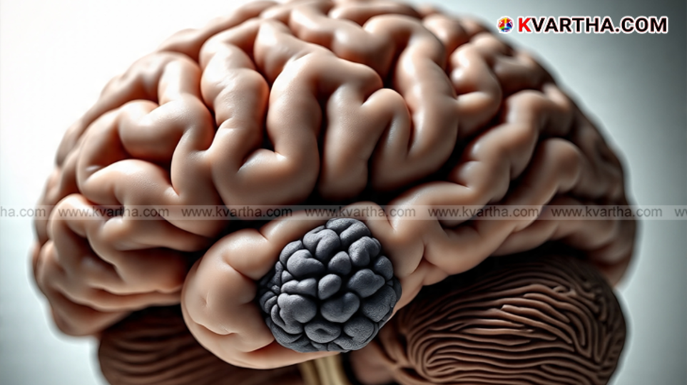 A brain showing a tumor, symbolizing the symptoms of brain tumor.