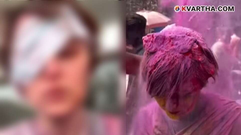 Austrian tourist Britta Schlagbauer sharing her eye injury experience during Vrindavan Holi