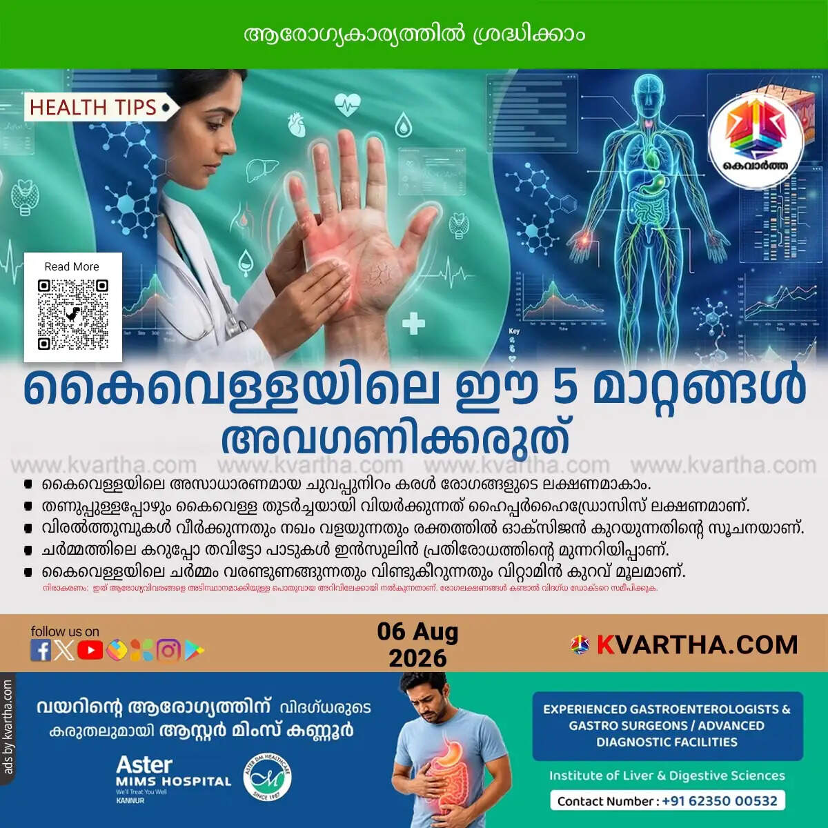 5 health warning signs revealed by palms symptoms