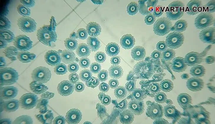 One dies of cholera in Trivandrum