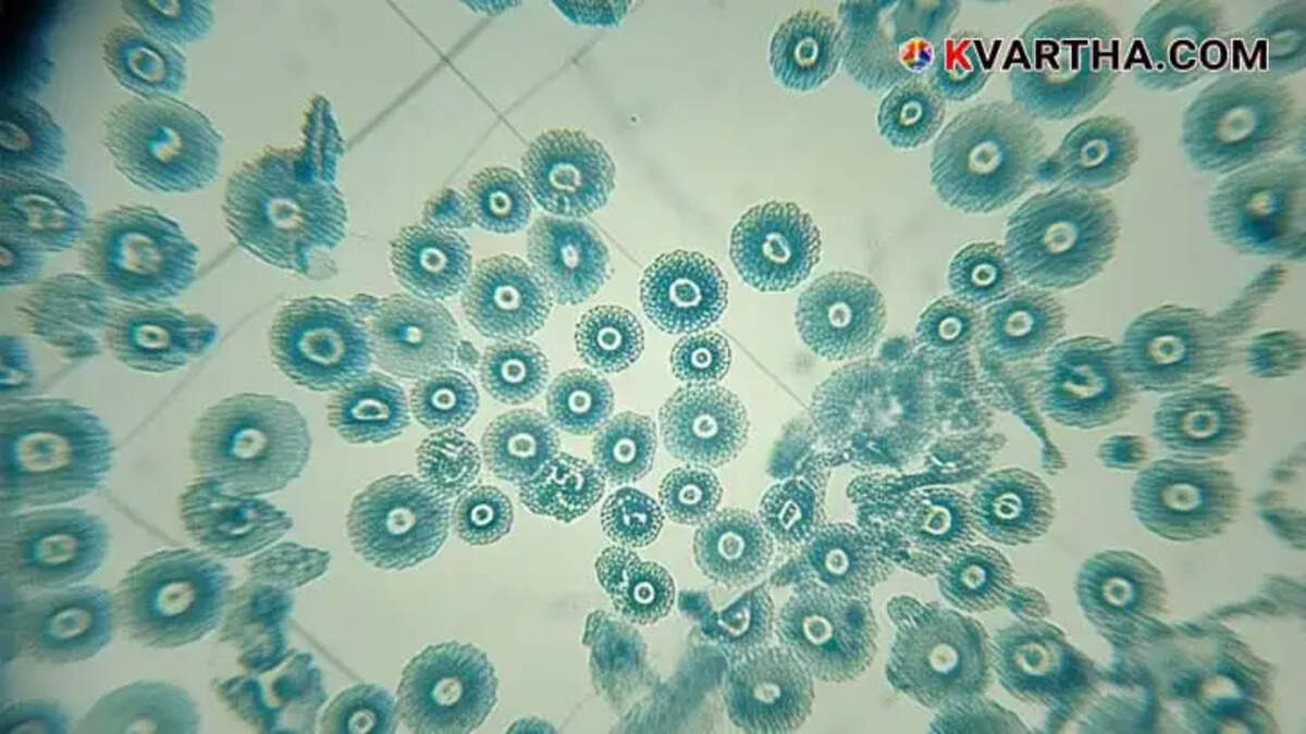 One dies of cholera in Trivandrum