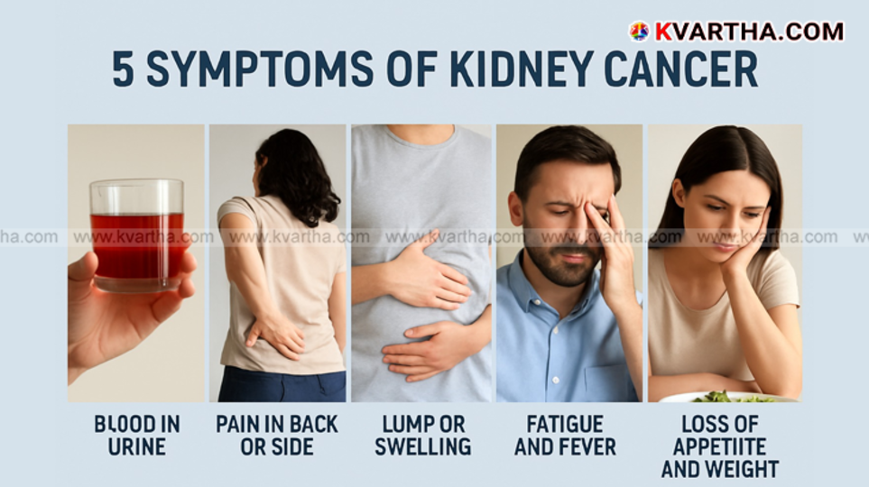 Kidney Cancer: Know the Five Key Signs to Identify Early and Prevent Severe Health Issues