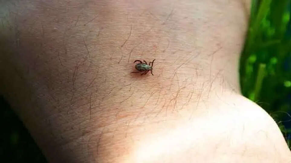 Lyme Disease