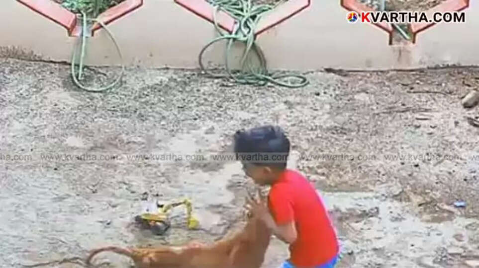  Four-year-old child Effrin Mobin with dog bite injury on shoulder.