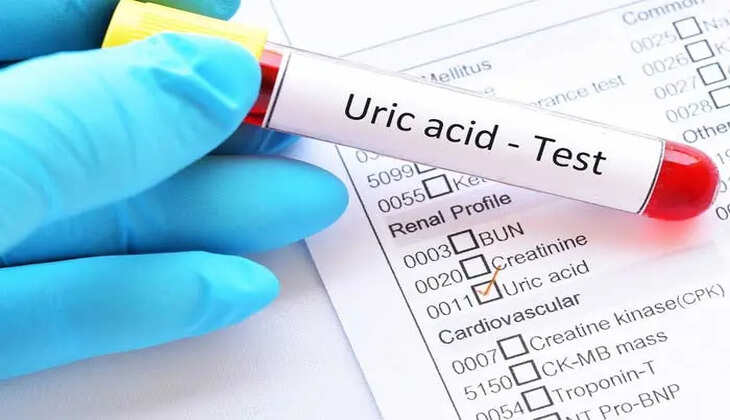 Uric acid