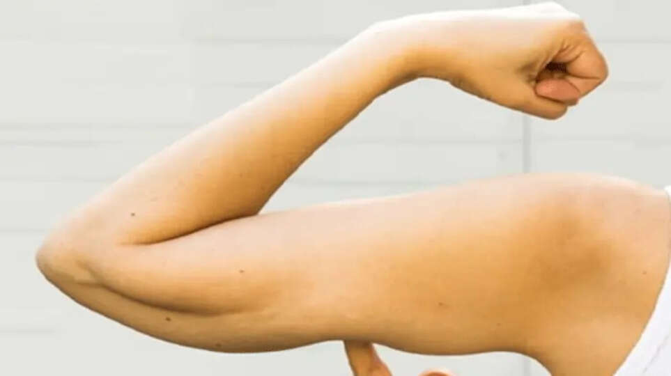 The Truth About Ozempic and Muscle Loss