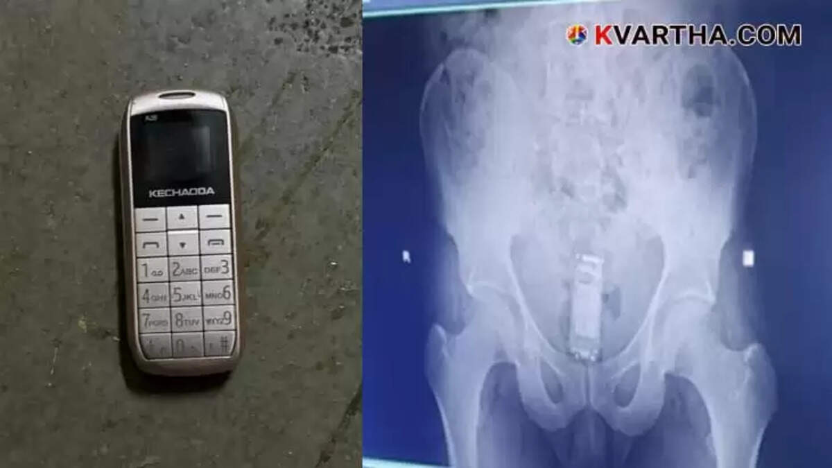 Prisoner Smuggles Mobile Phone Inside Rectum