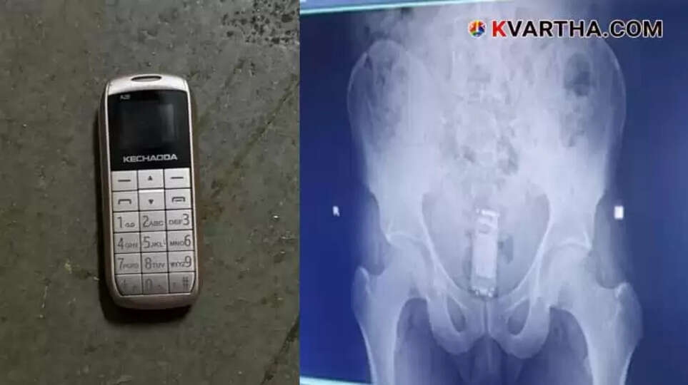 Prisoner Smuggles Mobile Phone Inside Rectum