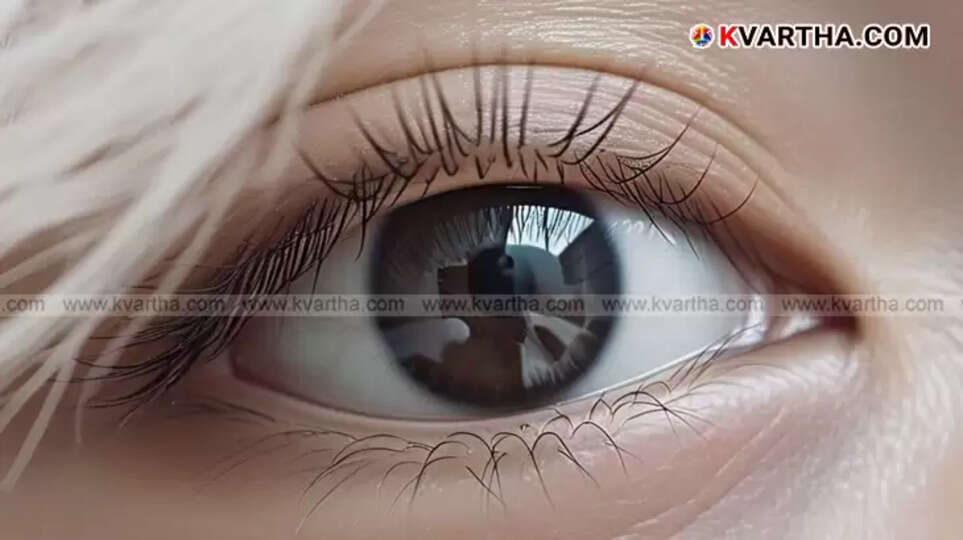 Dry eye symptoms
