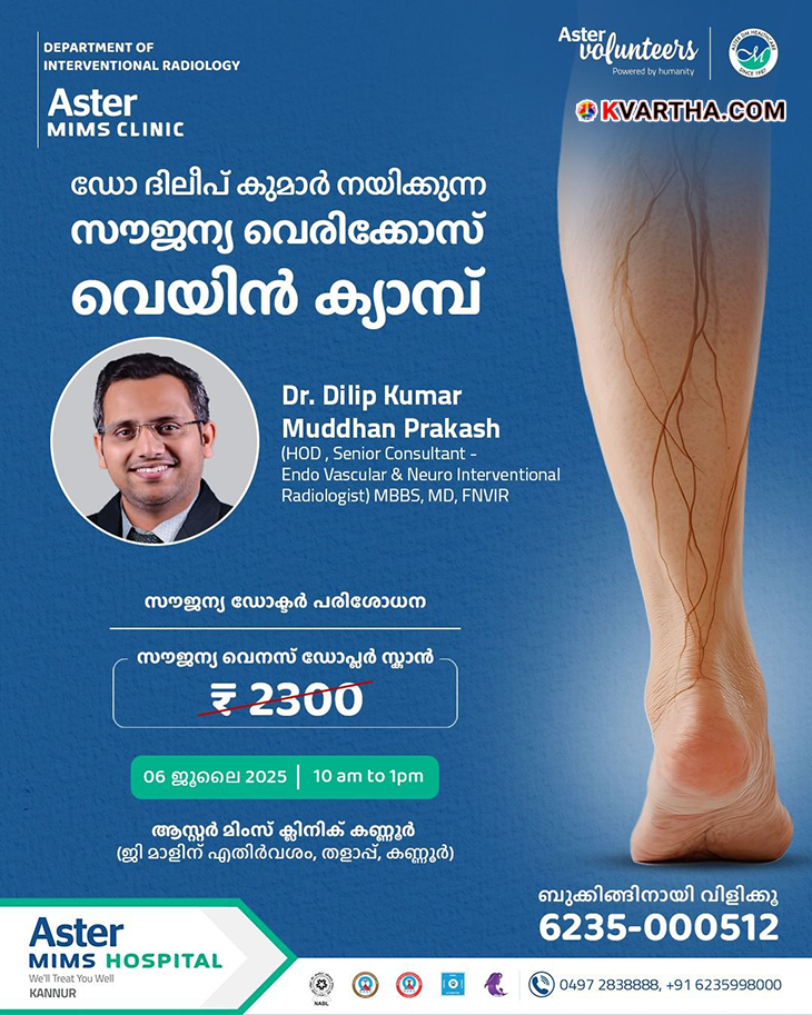 Aster Mims free varicose vein treatment camp