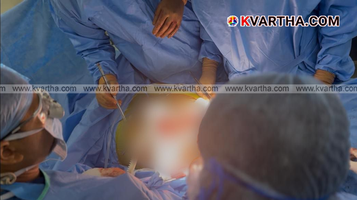 Conceptual image showing a medical team successfully completing a kidney transplant surgery.