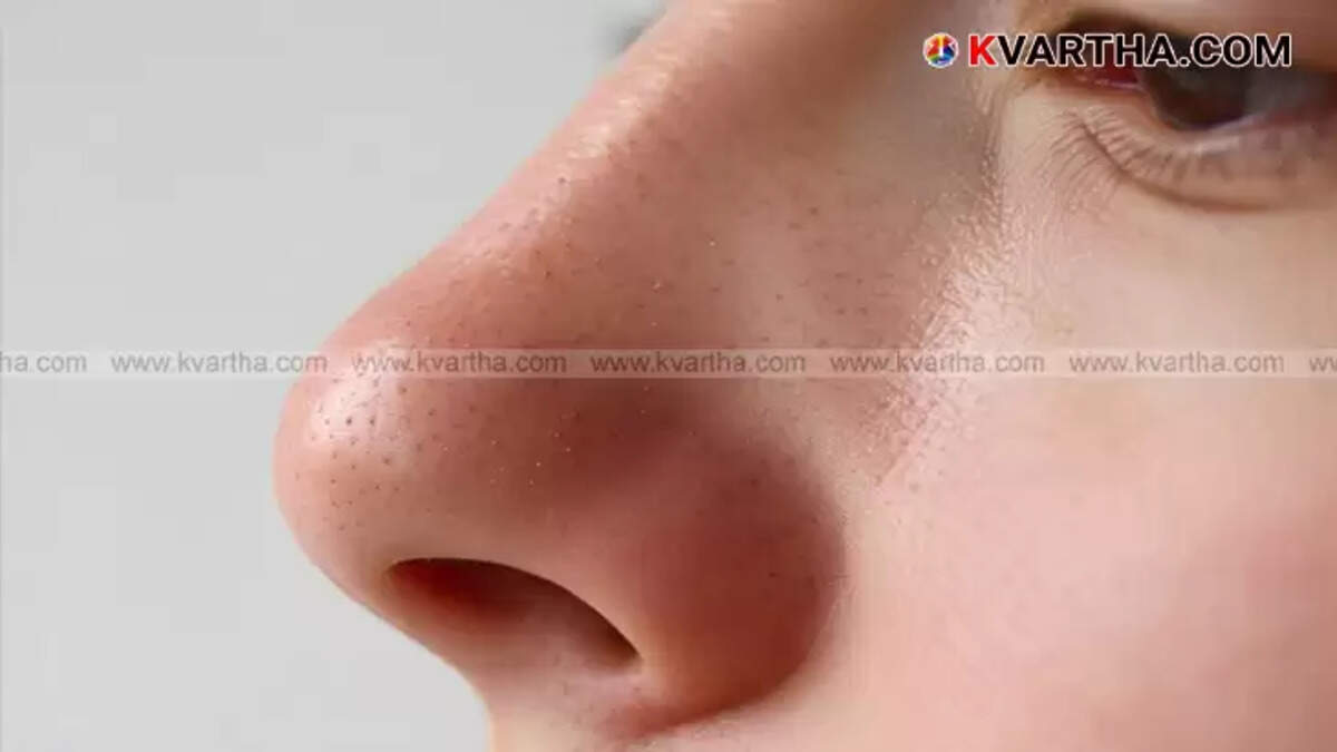 $11,000 Nose Surgery; Woman Starts New Life After Divorce