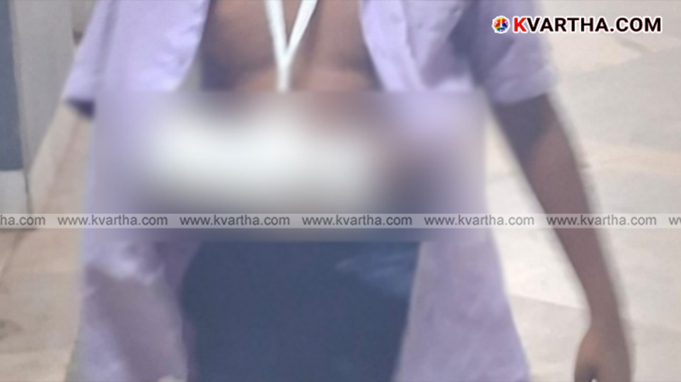School student with fractured hand after bus assault