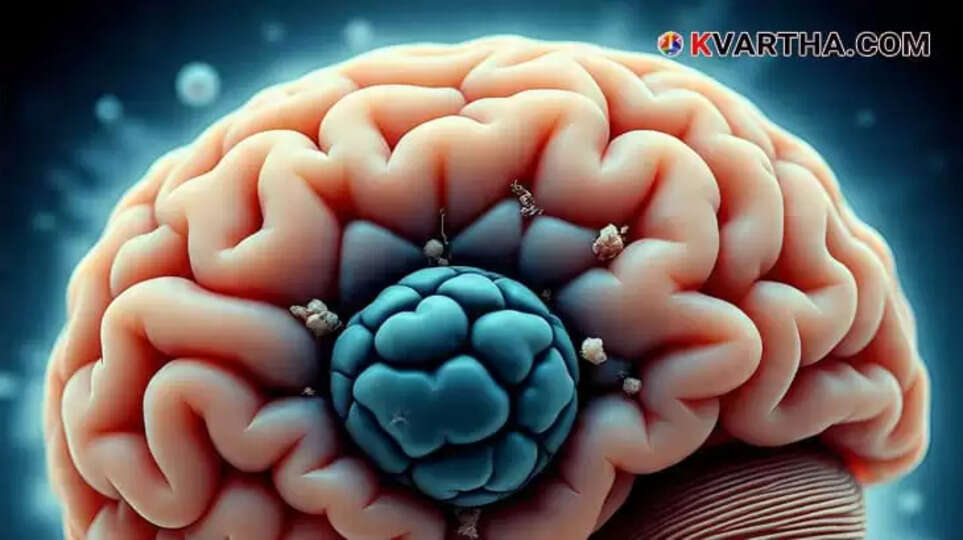 Image Representing Rare Amoebic Meningoencephalitis Confirmed in a 10-Year-Old Boy in Kerala