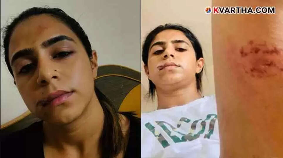 Actress Jaseela Parveen with severe facial injuries.