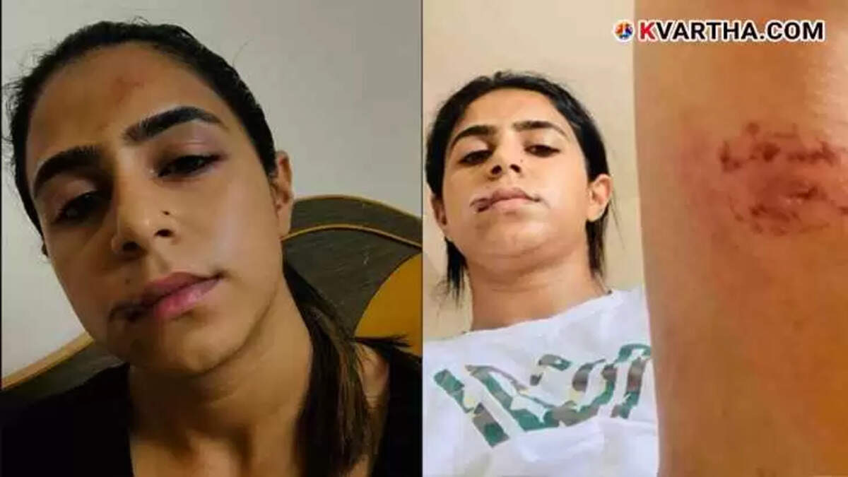 Actress Jaseela Parveen with severe facial injuries.