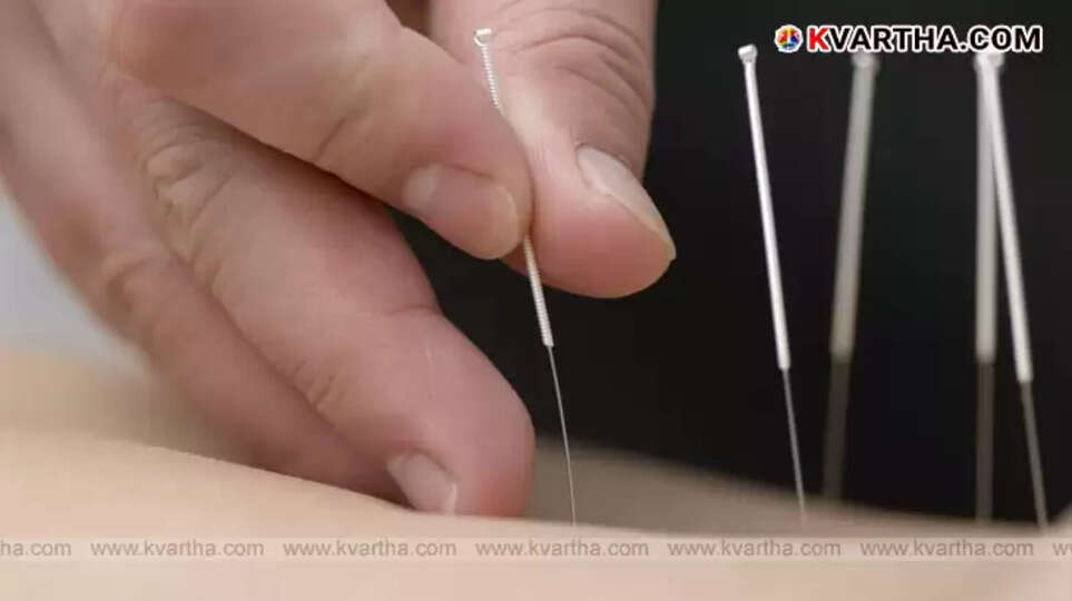 Unlicensed acupuncture treatment session