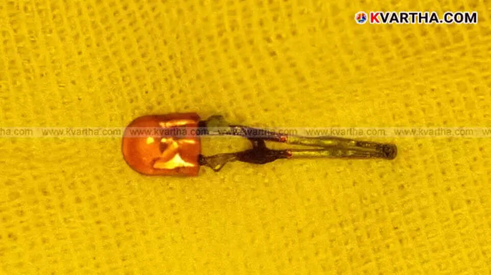 Nine-Year-Old Boy Recovers After Swallowing LED Bulb in Ahmedabad