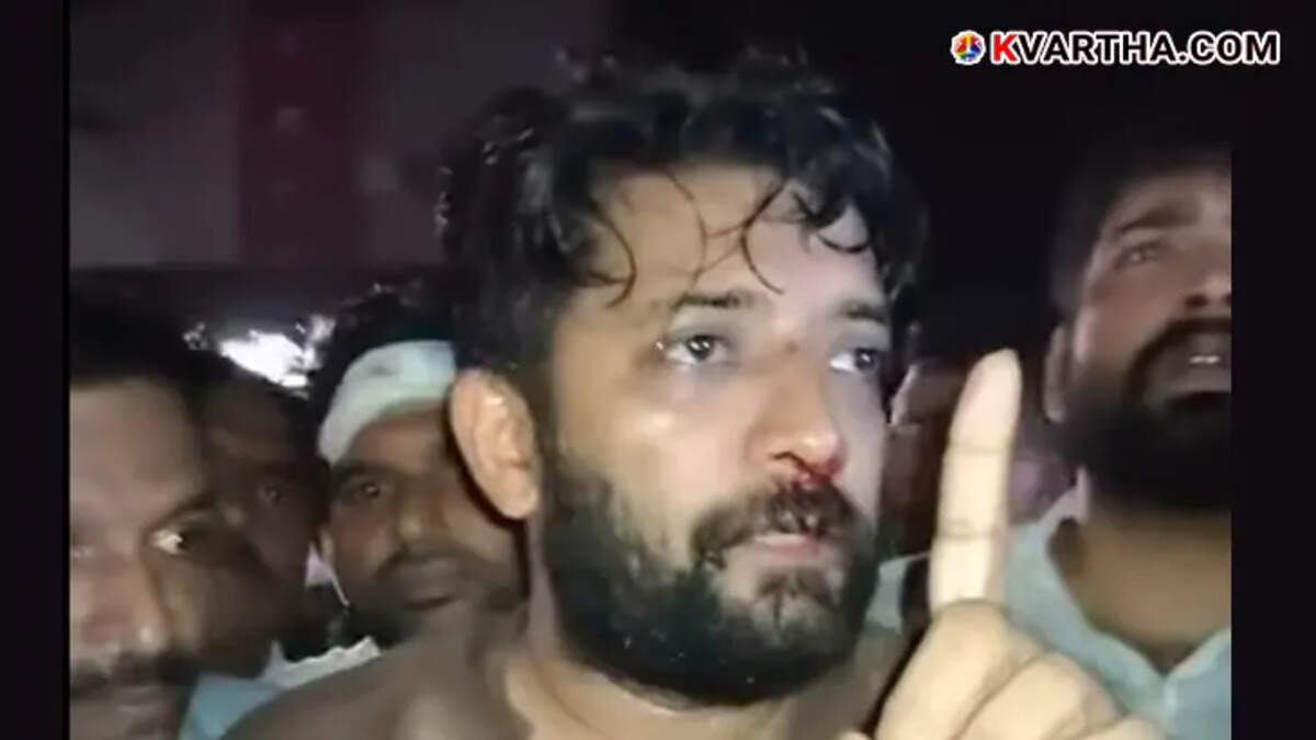 Shafi Parambil MP injured in Perambra clash