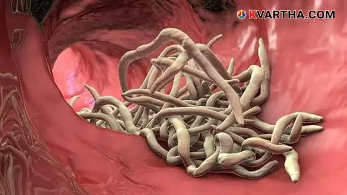Worm Infestation Threatens Children's Health